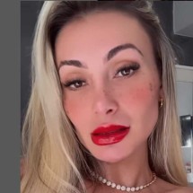 Rosto de Andressa Urach: entenda a técnica de tatuagem de sardas - Redes Sociais/ Reprodução