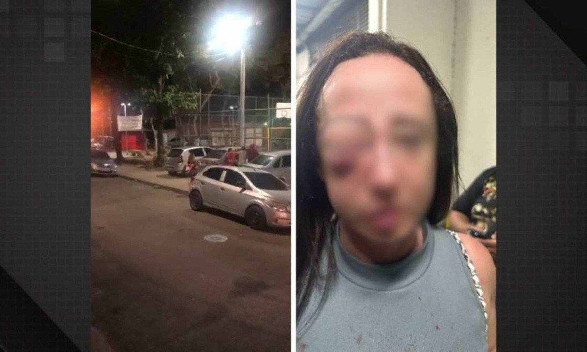 Agressão em estacionamento deixou rosto de professora deformado -  (crédito: frame de vídeo/dailymotion - reprodução/redes sociais)