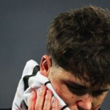 Jogador do Barcelona leva 10 pontos no rosto após entrada de adversário - No Ataque Internacional