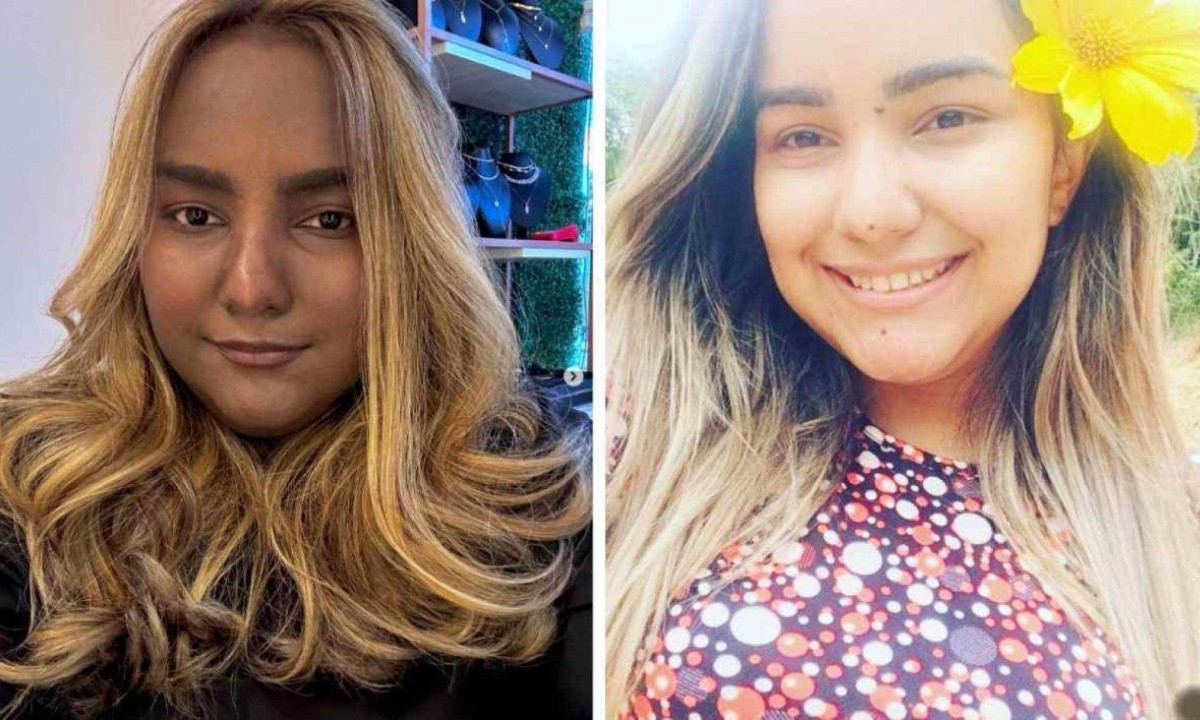 Sabrina teve alterações na cor de pele devido à Síndrome de Cushing e a um tumor raro no tórax -  (crédito: Reprodução / Instagram)