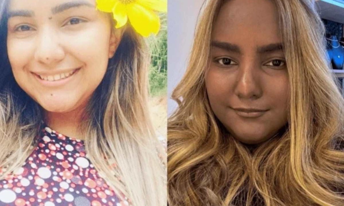 Jovem mudou cor de pele após tumor no tórax  -  (crédito: Redes Sociais/ Reprodução)