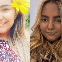 Cor da pele de jovem muda após diagnóstico de tumor raro no tórax - Redes Sociais/ Reprodução