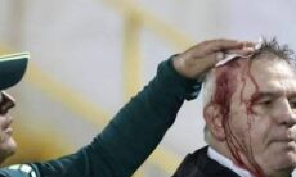 Técnico de seleção é ferido por torcedores após derrota -  (crédito: No Ataque Internacional)