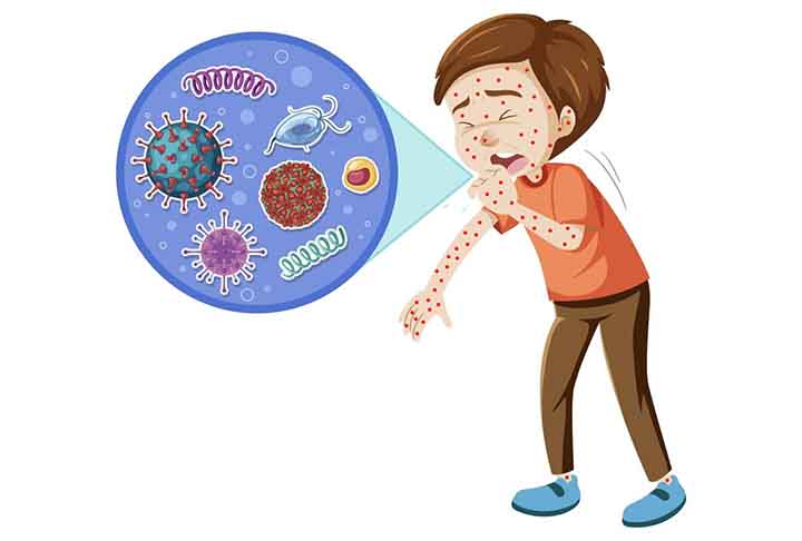 O sarampo é uma doença infecciosa grave que pode até levar à morte. A transmissão é pelo ar, quando a pessoa infectada tosse, espirra ou até mesmo fala perto de outra. 