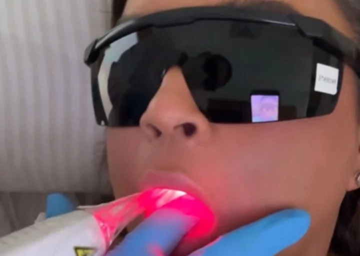 “Ela veio me salvar. A mucosite incomoda muito e o laser ajuda demais!”, declarou Preta Gil em vídeo postado em sua página no Instagram. A artista explicou ter passado por sessão de laserterapia.
