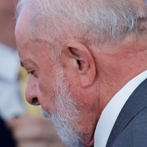 Como funciona o procedimento endovascular, cirurgia complementar que Lula vai fazer - EPA-EFE/REX/Shutterstock