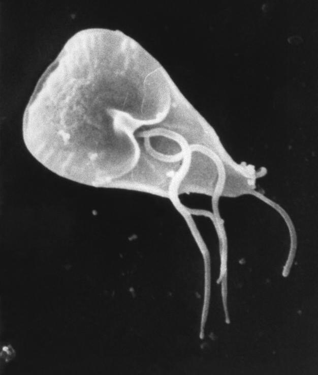 Giardíase - Causada pelo protozoário Giardia lamblia, a infecção ocorre pelo consumo de água ou alimentos contaminados. Os sintomas principais são diarreia, dor abdominal e náuseas.