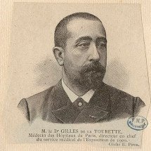 Síndrome de Tourette: Entenda o problema de saúde que afastou Lewis Capaldi dos palcos - Domínio público 