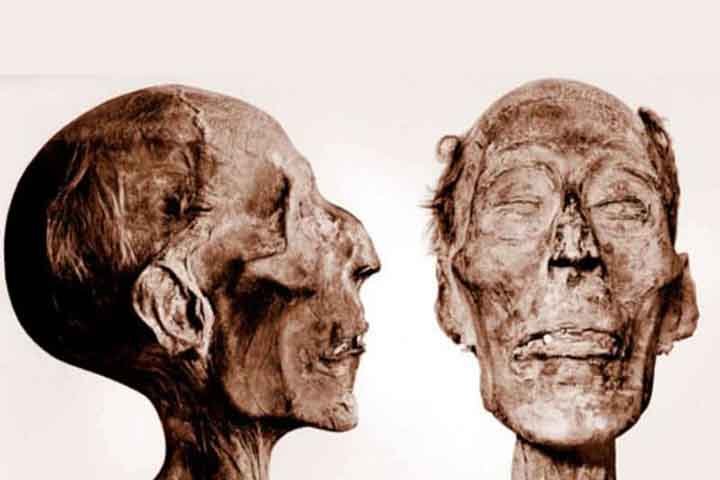 Ele morreu aos 90 anos por causa de 