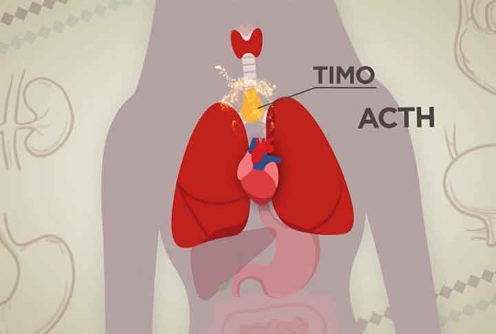 Para piorar o quadro, o tumor secreta o hormônio ACTH, que induz as adrenais a produzirem doses excessivas do hormônio cortisol. Essas glândulas estão situadas acima dos rins.
