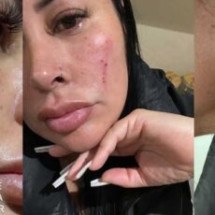 Esposa de jogador brasileiro afirma ter sido vítima de xenofobia e agressão em Portugal - No Ataque Internacional