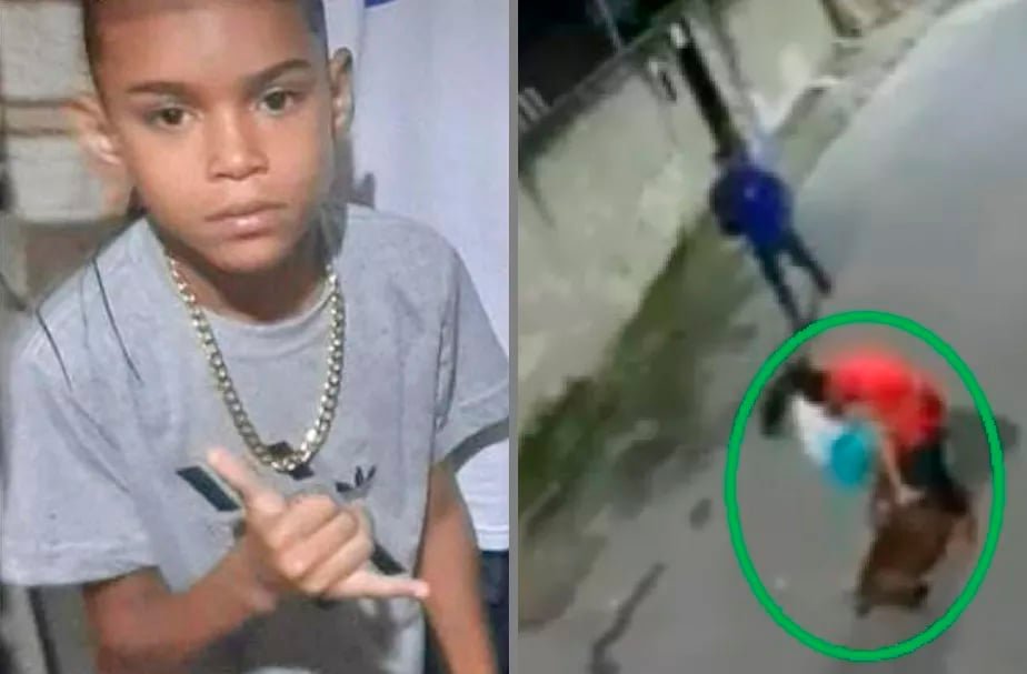 Nicolas Paz, de 10 anos, teve a panturrilha dilacerada por um pitbull que, segundo moradores, foi abandonado na rua e passou a atacar pessoas na Baixada Fluminense.-reprodução tv 