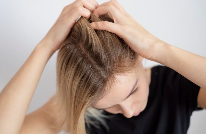 A máscara capilar ajuda no tratamento do cabelo, mas não deve ser aplicada na raiz, pois isso pode provocar excesso de oleosidade, favorecendo o surgimento de caspas. Para usar, aplique a máscara após lavar o cabelo com shampoo, distribuindo uniformemente pelos fios, e deixe agir de 5 a 20 minutos. Enxágue bem e finalize com condicionador para selar a hidratação.