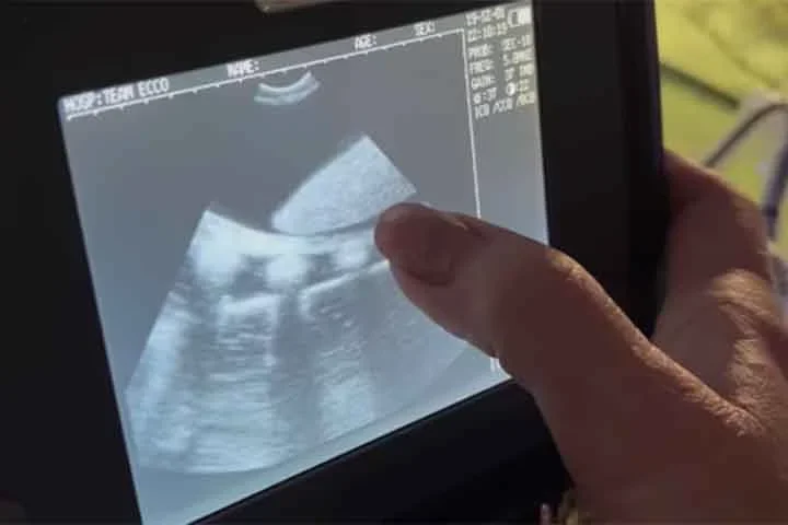 Em suas redes sociais, a direção do local compartilhou à época imagens do ultrassom da gravidez “solo” da arraia. 
