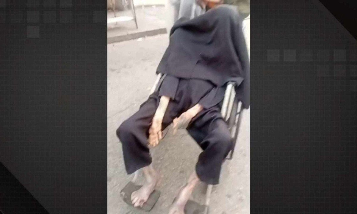 Filho carrega corpo da mãe em decomposição pelas ruas da Zona Oeste do Rio -  (crédito: Reprodução/Redes Sociais)