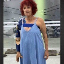 Escritora Roseana Murray, já com prótese biônica no lugar do braço direito, amputado depois que ela foi atacada por pitbulls -  (crédito: divulgação/instagram)