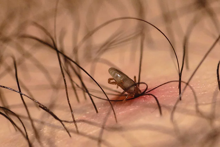 Um programa de banhos regulares com produtos para carrapatos deve ser seguido para eliminar os insetos e evitar novas infestaÃ§Ãµes. 