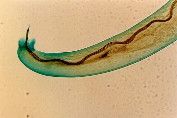 A causa foi a infecção pelo parasita Angiostrongylus cantonensis, conhecido como verme do pulmão de rato, comum em regiões tropicais e subtropicais. -wikimedia commons/Punlop Anusonpornperm