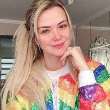 Ex-BBB Marcela Gowan vai remover pinta maligna na pele - Divulgação