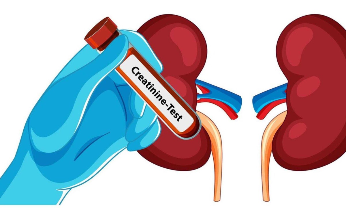 Os rins sÃ£o responsÃ¡veis por funÃ§Ãµes vitais, como filtrar as toxinas do sangue e controlar a pressÃ£o arterial -  (crédito: FreePik)