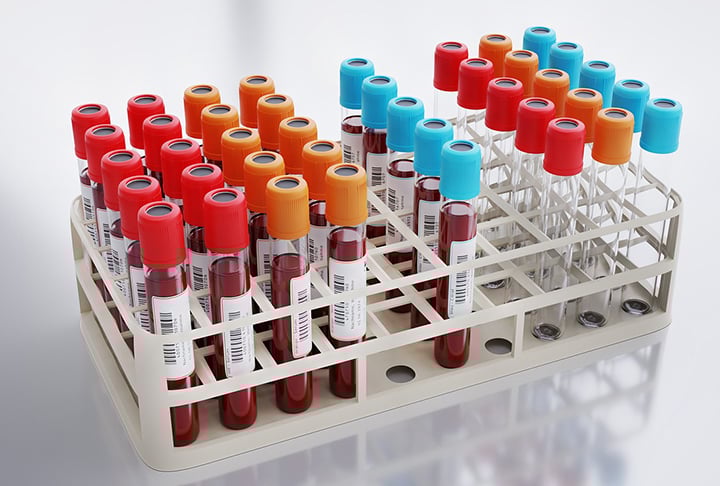 Qual o volume de sangue coletado? Na doação, são retirados no máximo 9ml de sangue por quilo do doador. A pessoa deve pesar pelo menos 50 kg, para uma doação de 450 ml. O máximo de volume a ser doado é de 495ml.-Imagem de MasterTux por Pixabay