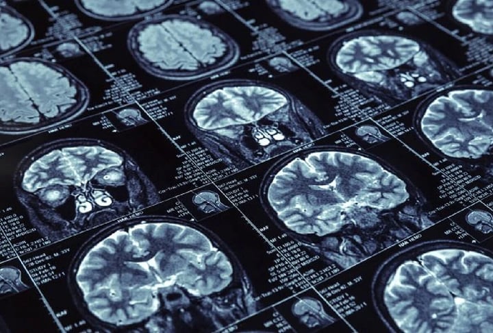 Antes deste, o paciente mais jovem diagnosticado com o problema tinha 21 anos e também era chinês. 