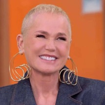 Mulheres podem ficar calvas? Entenda diagnóstico de Xuxa