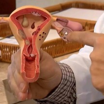Endometriose na adolescência: quando a cólica forte dispara sinal de alerta - Frame/TV Brasil