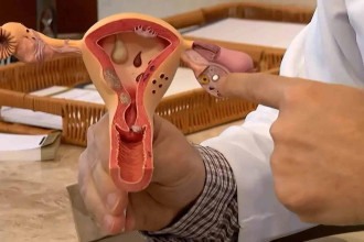 Endometriose na adolescência: quando a cólica forte dispara sinal de alerta