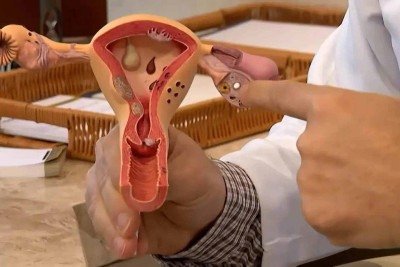 Um dos sintomas da endometriose &eacute; a c&oacute;lica intensa durante a menstrua&ccedil;&atilde;o, que pode ser constante e progressiva -  (crédito: Frame/TV Brasil)