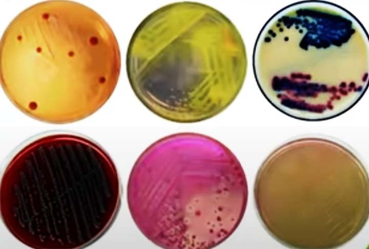 Koch tambÃ©m desenvolveu mÃ©todos e tÃ©cnicas laboratoriais, como a cultura de bactÃ©rias em meios sÃ³lidos e o uso de corantes para a visualizaÃ§Ã£o microscÃ³pica de microrganismos, que sÃ£o prÃ¡ticas padrÃ£o atÃ© hoje