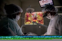 Implantes dentários sem cortes permite reabilitação rápida - DINO