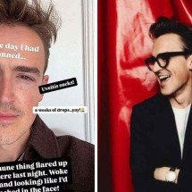 Cantor do McFly é internado por doença autoimune: 'Pancada na cara' - Redes sociais