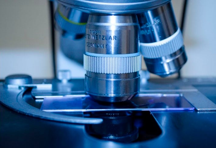 Em geral, os médicos analisam o "ABCD" da mancha e, caso desconfiem, aspiram um pedaço e enviam para a biópsia. No laboratório, há a confirmação ou não da doença. 