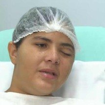 Adolescente tem crânio perfurado por palito de churrasco dentro de ônibus - Reprodução/TV Globo