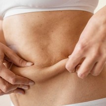 Lifting corporal cresce como cuidado estético após canetas emagrecedoras - Freepik