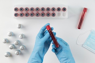 Laboratório Central de Saúde moderniza controle de exames médicos em Minas