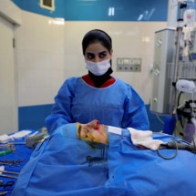 Cirurgia estética vive um 'boom' entre iranianas que buscam oportunidades - ATTA KENARE / AFP