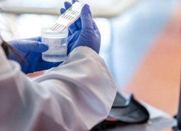 O caso ocorreu após o empregado ser submetido a um exame toxicológico  -  (crédito: Reprodução/Freepik)