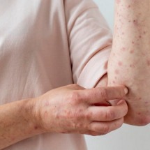 Açaí e caldo de cana realmente podem causar a doença de Chagas? - Freepik