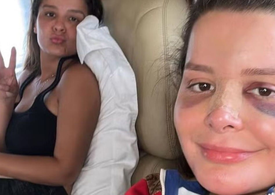 Celebridades que se recuperaram após acidentes