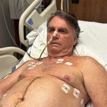 Bolsonaro apresenta boa evolução e segue na UTI e sem previsão de alta - Divulga&ccedil;&atilde;o/Redes Sociais