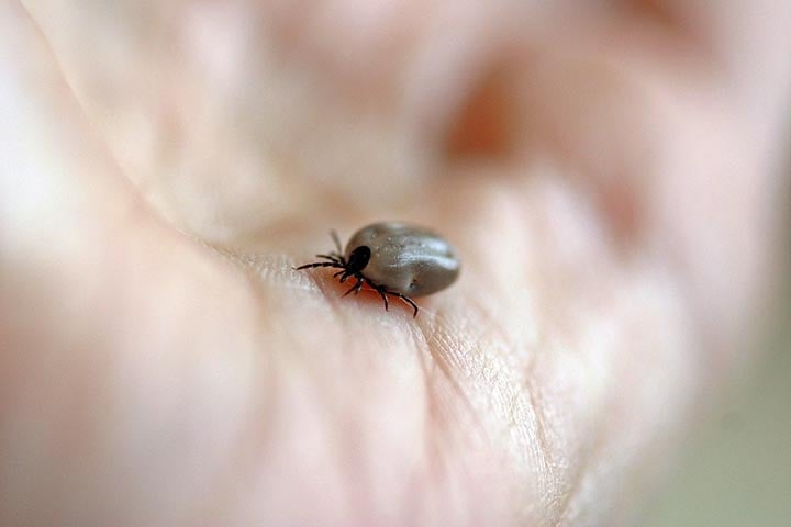 Depois, com uma pinça fina de ponta longa, segure o carrapato o mais próximo possível da pele do animal ou pessoa, agarrando-o pela cabeça.