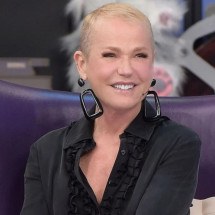 Xuxa passa por transplante capilar e revela detalhes do procedimento - Tupi - Pablo Oliveira