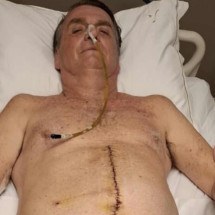 Como Bolsonaro usa o próprio corpo como ferramenta de engajamento político