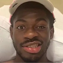 Paralisia facial súbita: você conhecia a doença do rapper Lil Nas X? - Reprodução/ Instagram