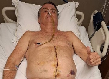 O ex-presidente Jair Bolsonaro, em foto publicada no dia 22 de abril, durante internação em UTI  -  (crédito: Reprodução /Jair Bolsonaro no Instagram)