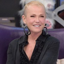 Xuxa passa por transplante capilar e revela detalhes do procedimento - Tupi - Pablo Oliveira