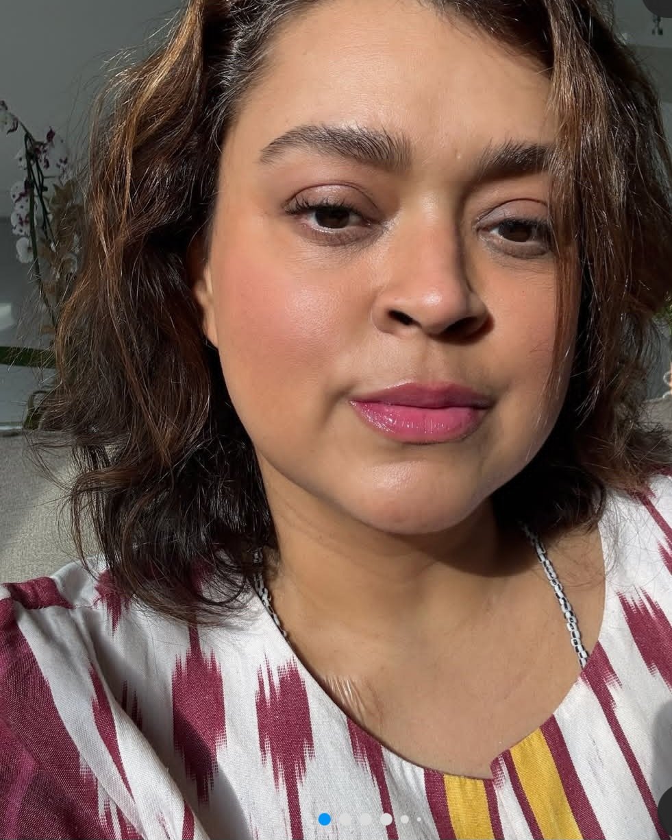 A cantora, que trata um câncer de intestino que evoluiu para metástase no peritônio, recebeu alta hospitalar dez dias antes do show. Ela ficou mais de duas semanas internada.

