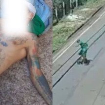Gari é atacado por dois pitbulls durante o trabalho - ReproduÃ§Ã£o/Redes sociais